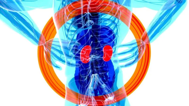 استئصال الكلية، جراحة إزالة الكلية