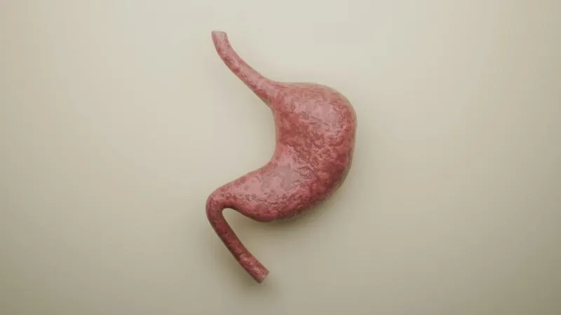 علاج مريء باريت