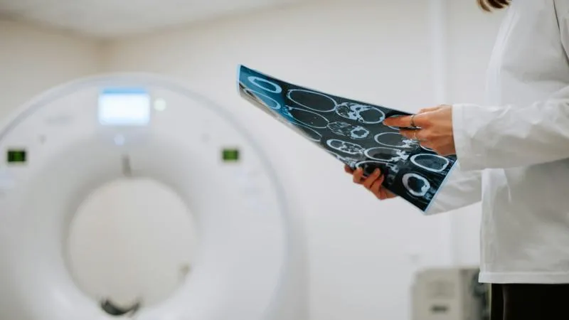 تصوير PSMA PET/CT لسرطان البروستاتا
