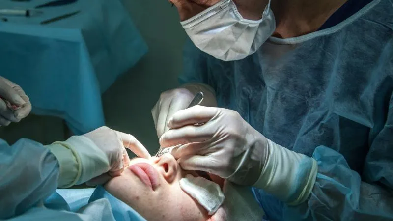 جراحة تجميل الأنف