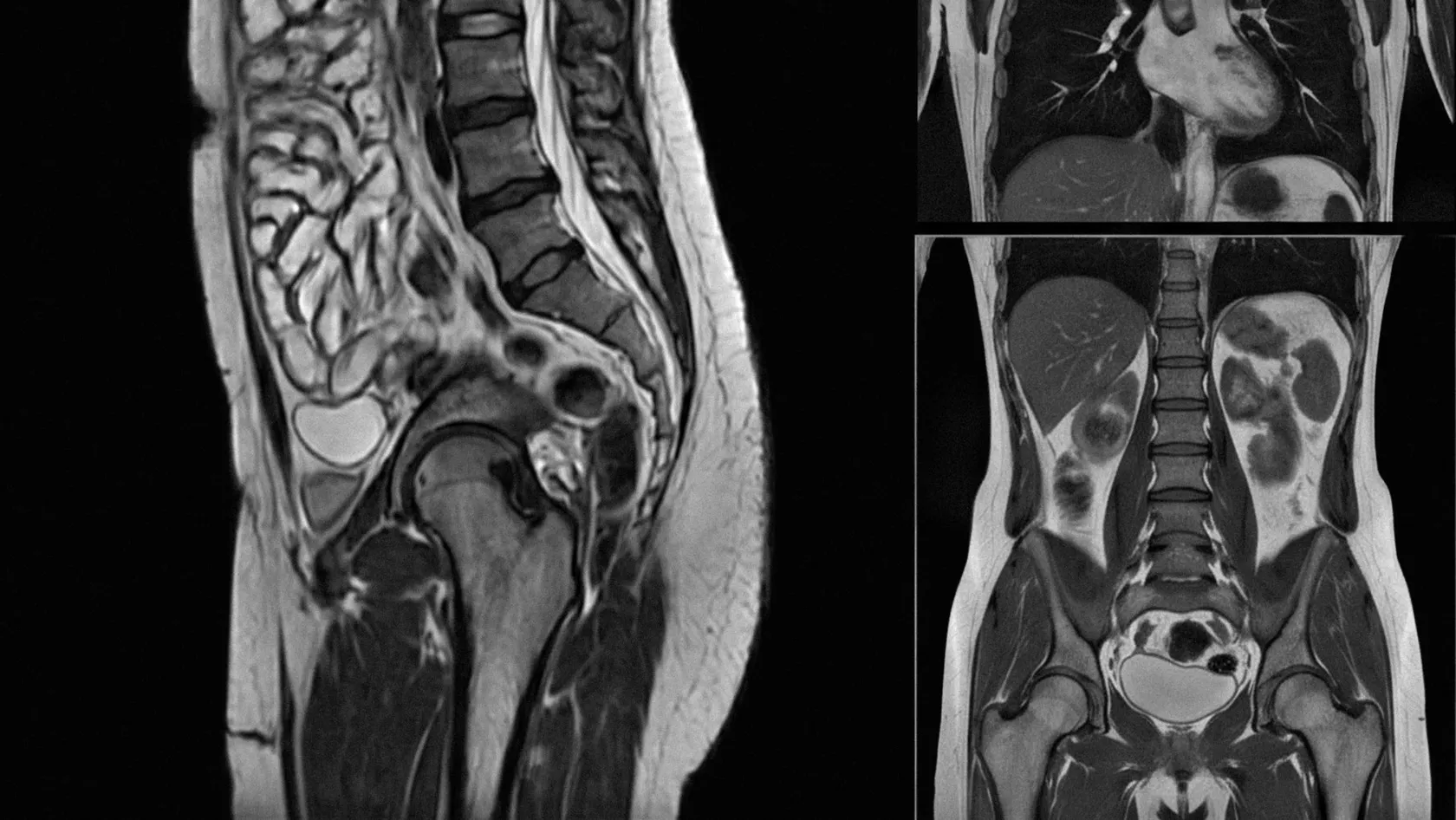 ERCP، تصوير القنوات الصفراوية والبنكرياسية الراجع بالمنظار