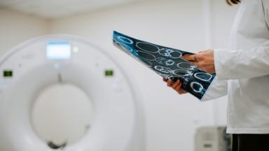 تصوير PSMA PET/CT لسرطان البروستاتا